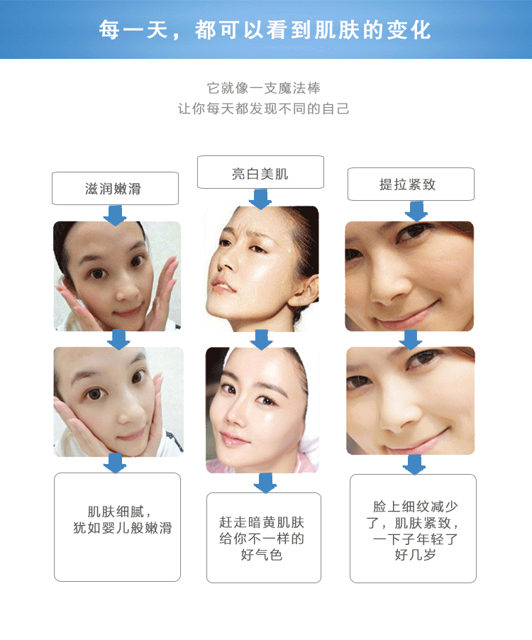 负离子导入射频美容仪